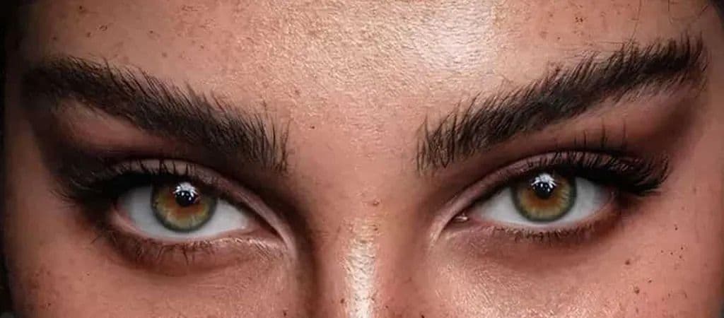 Fox Eye Surgery in Istanbul — Estetica Istanbul