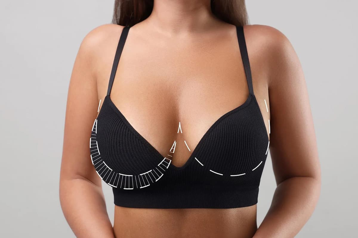 Breast Reduction in Istanbul — Estetica Istanbul