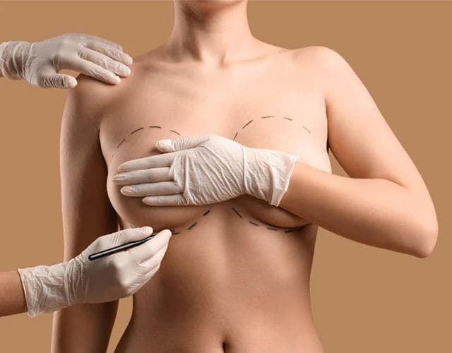 Breast Lift in Istanbul — Estetica Istanbul