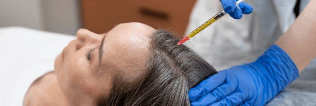 Which Shampoo After Hair Transplant? Istanbul Clinic Guide (FR primary)