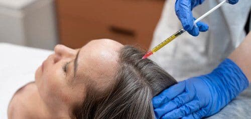 Female Hair Transplant