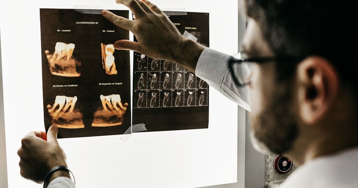 Corone E-Max vs Zirconia: Quale Materiale è Migliore per il Tuo Sorriso?