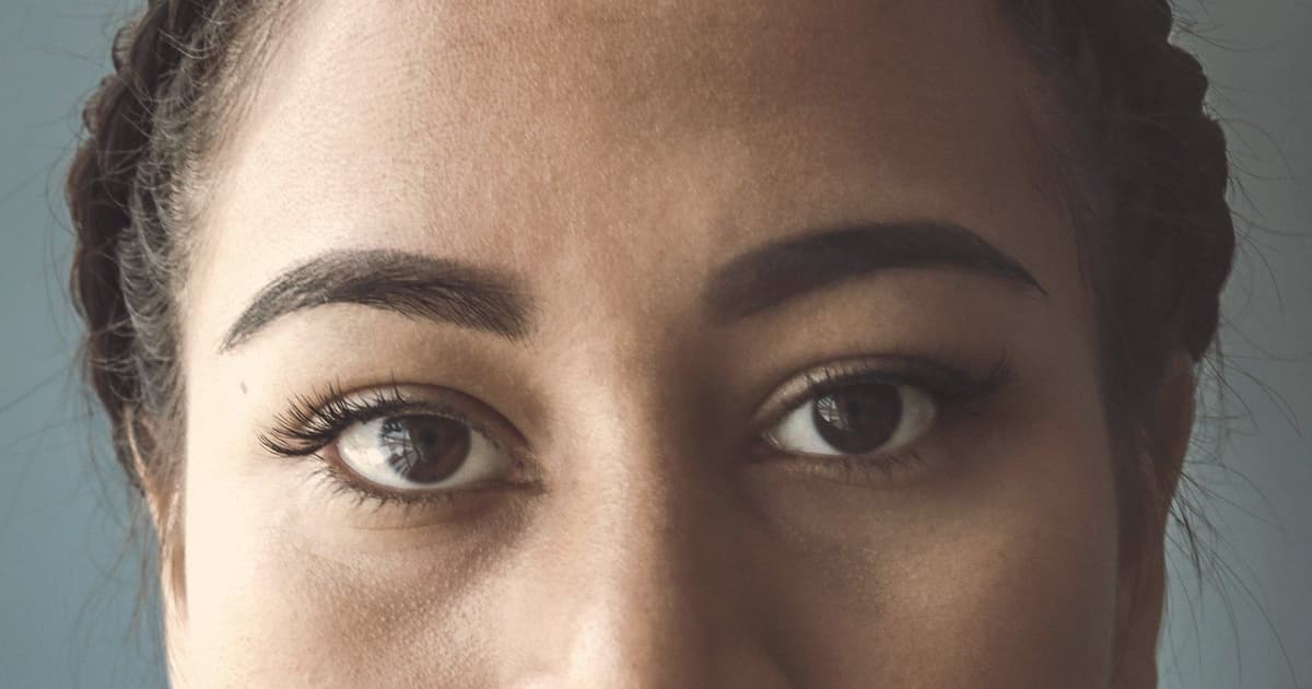 Blefaroplastikadan sonra bərpa müddəti: həftəbəhəftə qrafik