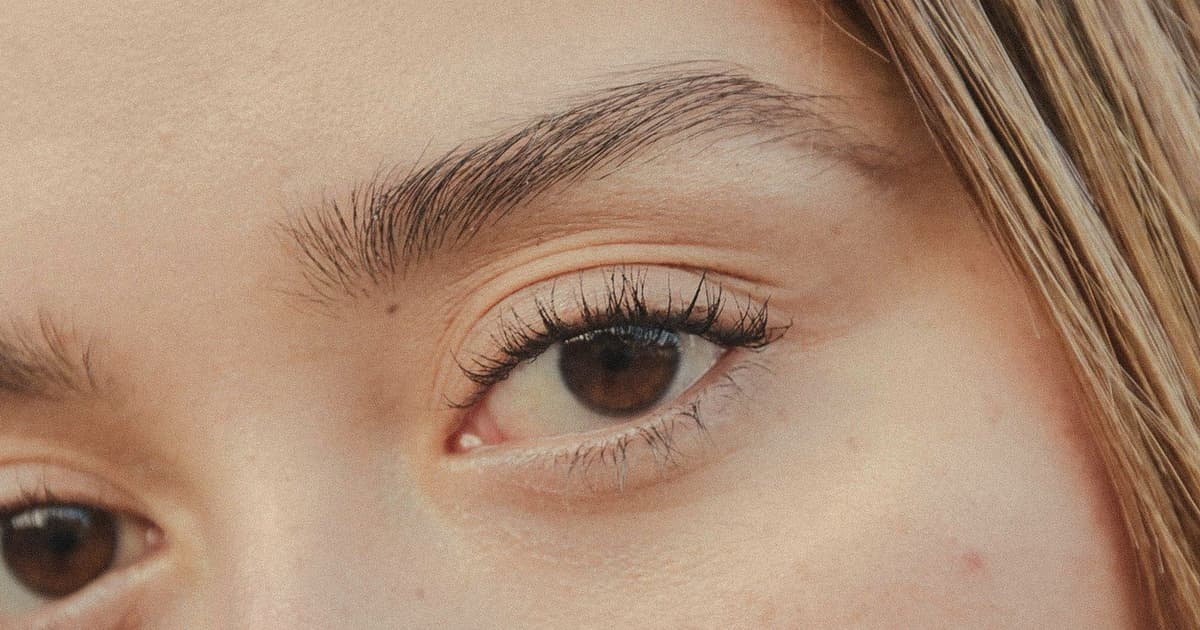 Türkiyədə fox eye lift qiyməti 2026: qiymət, cərrahiyyə və saplar, bərpa