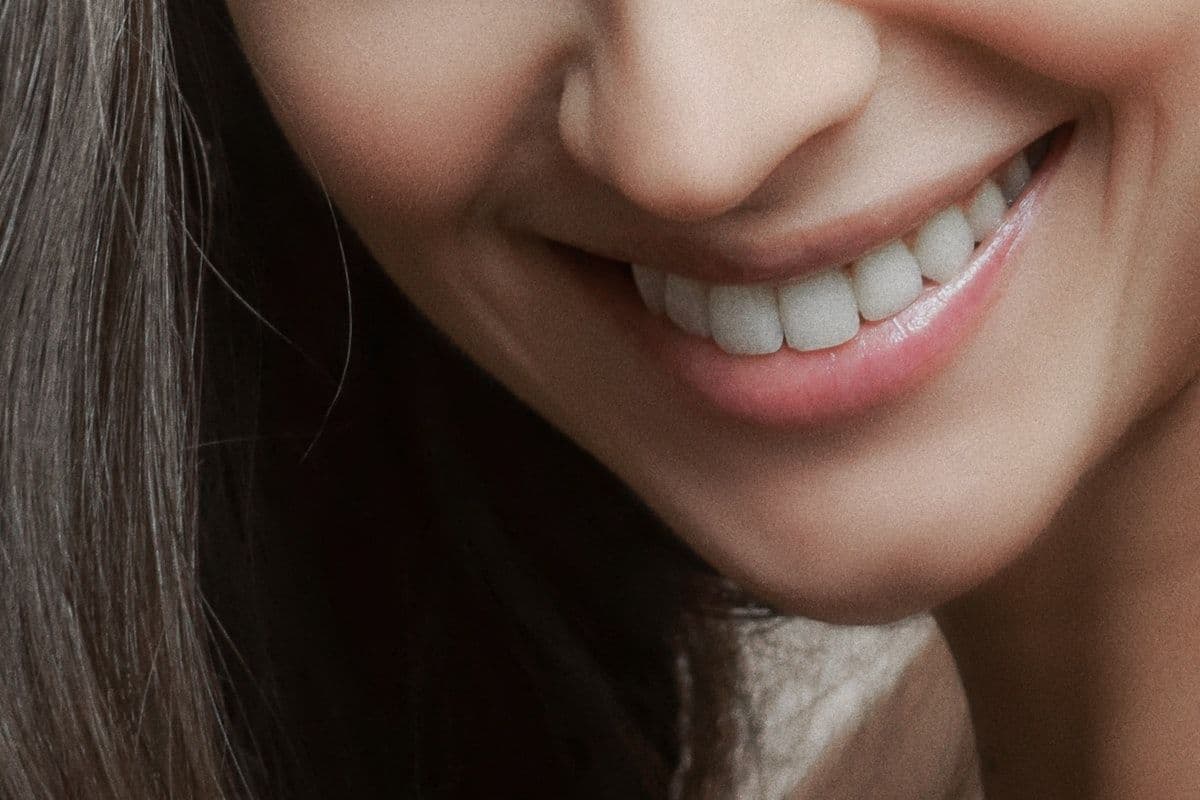 ¿Cuánto cuestan las carillas dentales? Comparación de precios completa: Turquía vs Reino Unido vs Alemania (2026)