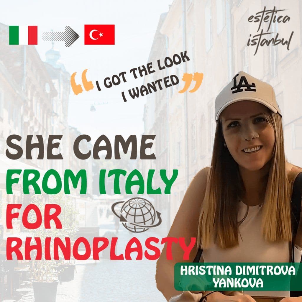 Rhinoplasty
