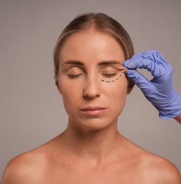 What Should Be Considered After Eyelid Aesthetics Blepharoplasty