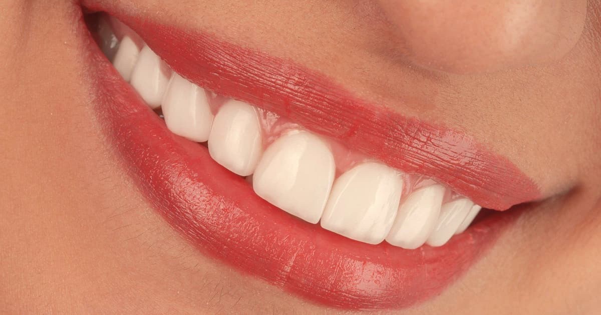 Turismo Dental en Turquía: ¿Es Seguro? Lo que los Pacientes Deben Saber