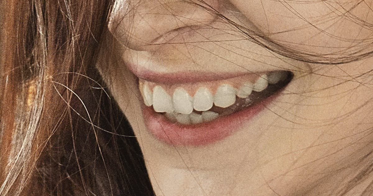 Türkiyədə Hollywood Smile: İstanbulda diş vinirləri üzrə tam bələdçi