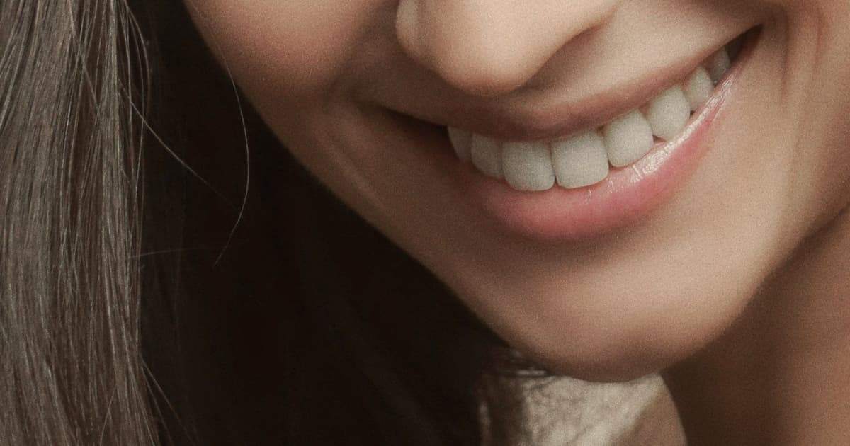 Blanqueamiento dental en Turquía: 230 € y cuándo gana a las carillas