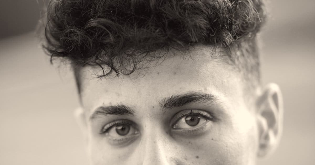 Saç köçürülməsinin nəticələri: əvvəl və sonra — nə realdır?