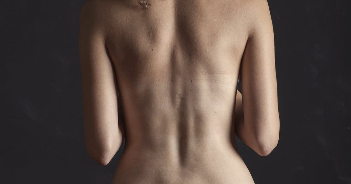 İstanbulda döş böyütmə: implant növləri, qiymətlər və bərpa bələdçisi