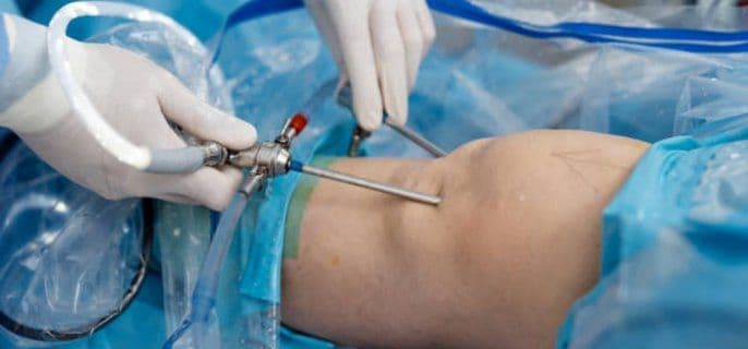 Aumento de Glúteos (BBL)