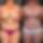 Breast reduction Before & After — Dr. Barış Kanık (Case K-red-03)